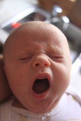 Stella yawning face